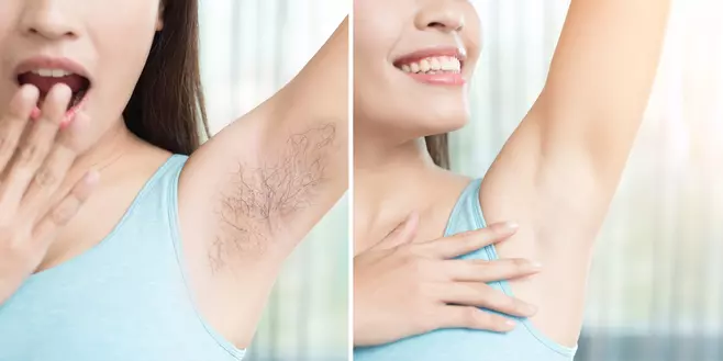 Is armpit Laser Hair Removal Effective?