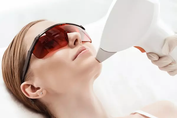 Which Laser Hair Removal Method is Better